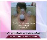 طب سنتی در مدائن , طب سوزنی در مدائن
