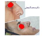 بهترین متخصص گوش و حلق و بینی در نیروی هوایی