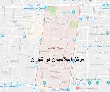مرکز اپیلاسیون در تهران