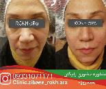کلینیک لیزر و پوست در شیراز 